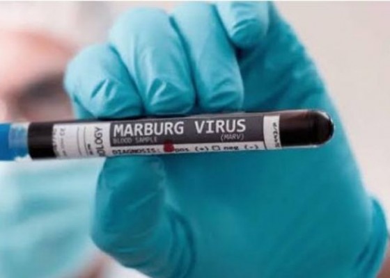 Nusabali.com - viral-virus-marburg-bagaimana-gejala-dan-cara-pencegahannya