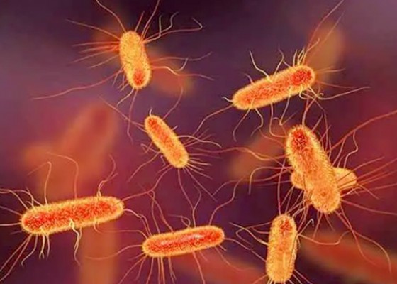 Nusabali.com - akibat-kontaminasi-bakteri-ecoli