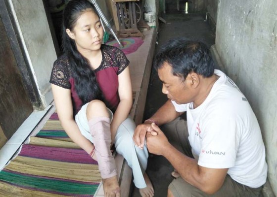 Nusabali.com - luka-terus-keluar-air-kaki-santi-tak-dioperasi-karena-keterbatasan-biaya