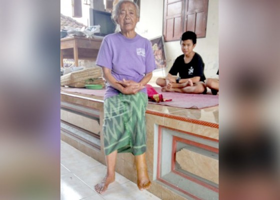 Nusabali.com - kaki-bengkak-nenek-pengungsi-kesulitan-jalan