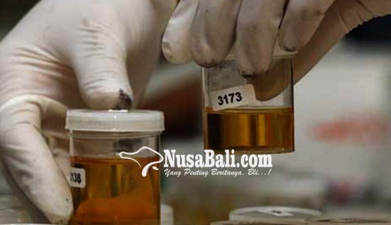 www.nusabali.com-bnnk-gianyar-gencarkan-test-urine