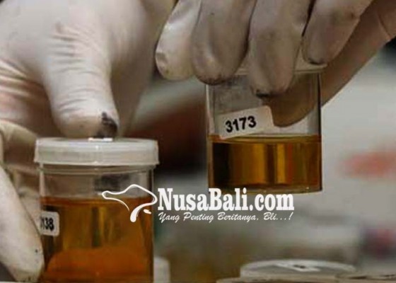 Nusabali.com - bnnk-gianyar-gencarkan-test-urine
