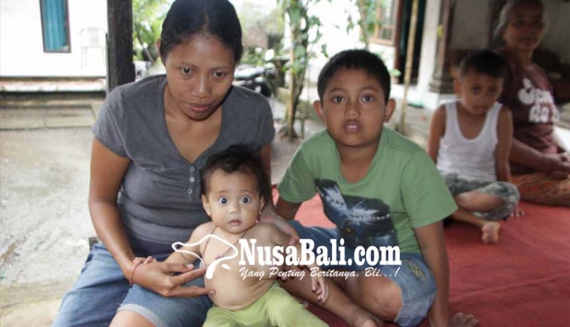 www.nusabali.com-bayi-14-bulan-derita-tumor-dan-epilepsi