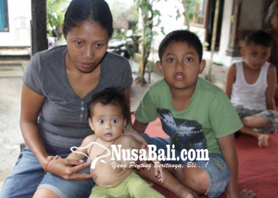 Nusabali.com - bayi-14-bulan-derita-tumor-dan-epilepsi