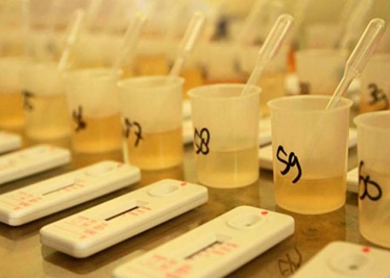 Nusabali.com - cegah-terjerat-narkoba-puluhan-anggota-tni-dites-urine