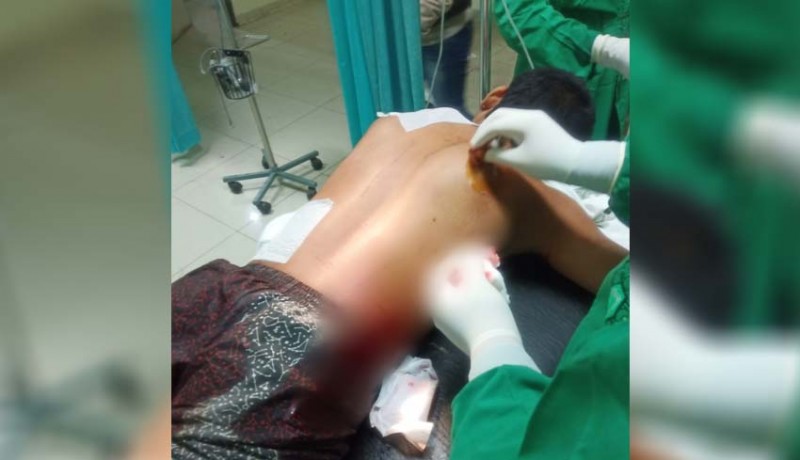 www.nusabali.com-tolak-tantangan-berkelahi-pemuda-di-gerokgak-mengalami-luka-tusuk