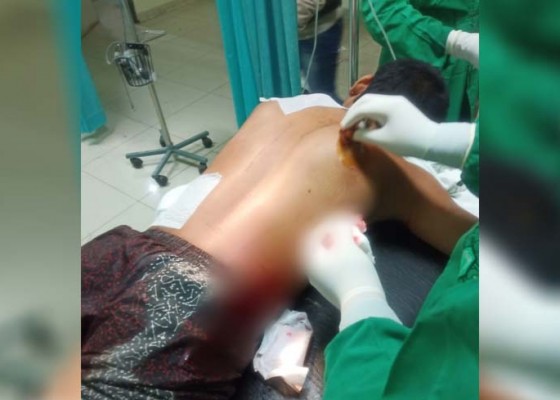 Nusabali.com - tolak-tantangan-berkelahi-pemuda-di-gerokgak-mengalami-luka-tusuk