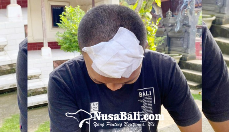 www.nusabali.com-diserang-sekelompok-pemuda-kepala-robek