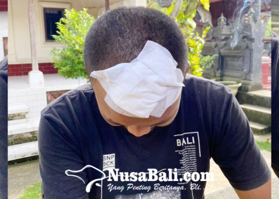 Nusabali.com - diserang-sekelompok-pemuda-kepala-robek