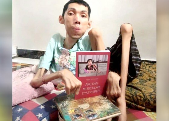 Nusabali.com - terbitkan-buku-ke-4-tentang-dia-dan-penyakitnya